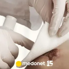 Dezynfekcja jakie ma znaczenie dla zdrowia i bezpieczeństwa w czasach pandemii